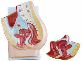 صورة مقطع حوض أنثوي (2 أجزاء) (Human Female Pelvis Section (2 parts)) - واقف للتجارة صنعاء صورة مقطع حوض أنثوي (2 أجزاء) (Human Female Pelvis Section (2 parts)) - واقف للتجارة صنعاء