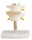صورة مجموعة فقرات قطنية (2 ) (Lumbar Set (2 pcs)) - واقف للتجارة صنعاء صورة مجموعة فقرات قطنية (2 ) (Lumbar Set (2 pcs)) - واقف للتجارة صنعاء