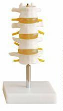صورة مجموعة فقرات قطنية (4 ) (Lumbar Set (4 pcs)) - واقف للتجارة صنعاء صورة مجموعة فقرات قطنية (4 ) (Lumbar Set (4 pcs)) - واقف للتجارة صنعاء