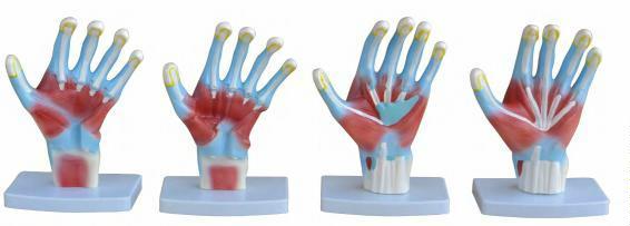 صورة تشريح راحة اليد (Palm Anatomy) - واقف للتجارة صنعاء صورة تشريح راحة اليد (Palm Anatomy) - واقف للتجارة صنعاء