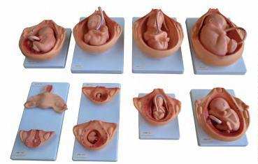 صورة مراحل تطور الجنين (The Development Process for Fetus) - واقف للتجارة صنعاء صورة مراحل تطور الجنين (The Development Process for Fetus) - واقف للتجارة صنعاء