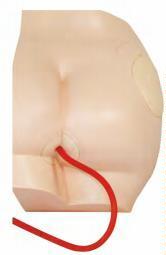 صورة مجسم الحقن في الأرداف (Buttock Injection Model) - واقف للتجارة صنعاء صورة مجسم الحقن في الأرداف (Buttock Injection Model) - واقف للتجارة صنعاء